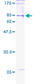 POLG2 Protein - 12.5% SDS-PAGE of human POLG2 stained with Coomassie Blue