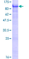 POLI Protein - 12.5% SDS-PAGE of human POLI stained with Coomassie Blue