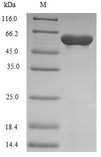 POLM / DNA Polymerase Mu Protein - (Tris-Glycine gel) Discontinuous SDS-PAGE (reduced) with 5% enrichment gel and 15% separation gel.