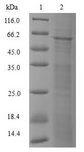 POLM / DNA Polymerase Mu Protein - (Tris-Glycine gel) Discontinuous SDS-PAGE (reduced) with 5% enrichment gel and 15% separation gel.