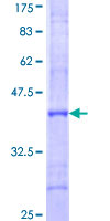 POLQ / DNA Polymerase Theta Protein - 12.5% SDS-PAGE Stained with Coomassie Blue.