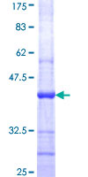POLR1B Protein - 12.5% SDS-PAGE Stained with Coomassie Blue.