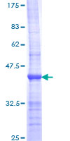POLR2A / RNA polymerase II Protein - 12.5% SDS-PAGE Stained with Coomassie Blue.