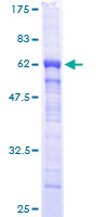 POLR2C Protein - 12.5% SDS-PAGE of human POLR2C stained with Coomassie Blue