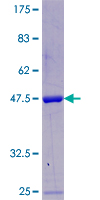 POLR2F Protein - 12.5% SDS-PAGE of human POLR2F stained with Coomassie Blue