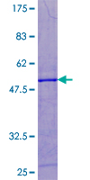 POLR2G / RPB7 Protein - 12.5% SDS-PAGE of human POLR2G stained with Coomassie Blue
