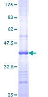 POLR2G / RPB7 Protein - 12.5% SDS-PAGE Stained with Coomassie Blue.