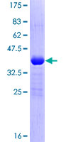 POLR2I Protein - 12.5% SDS-PAGE of human POLR2I stained with Coomassie Blue