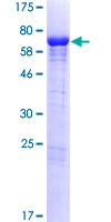 POLR2M Protein - 12.5% SDS-PAGE of human GRINL1A stained with Coomassie Blue
