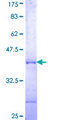 POLR3A Protein - 12.5% SDS-PAGE Stained with Coomassie Blue.