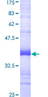 POLR3D Protein - 12.5% SDS-PAGE Stained with Coomassie Blue.