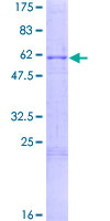 POMC / Proopiomelanocortin Protein - 12.5% SDS-PAGE of human POMC stained with Coomassie Blue