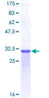 POMC / Proopiomelanocortin Protein - 12.5% SDS-PAGE Stained with Coomassie Blue
