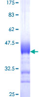 POMGNT1 Protein - 12.5% SDS-PAGE Stained with Coomassie Blue.