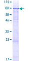 POMGNT2 / GTDC2 Protein - 12.5% SDS-PAGE of human C3orf39 stained with Coomassie Blue