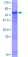 POMK / SGK196 Protein - 12.5% SDS-PAGE of human FLJ23356 stained with Coomassie Blue