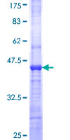 POMK / SGK196 Protein - 12.5% SDS-PAGE Stained with Coomassie Blue.