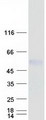 POMK / SGK196 Protein - Purified recombinant protein POMK was analyzed by SDS-PAGE gel and Coomassie Blue Staining