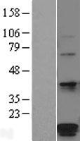 POMP / HSPC014 Protein - Western validation with an anti-DDK antibody * L: Control HEK293 lysate R: Over-expression lysate