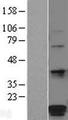 POMP / HSPC014 Protein - Western validation with an anti-DDK antibody * L: Control HEK293 lysate R: Over-expression lysate