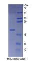 POMP / HSPC014 Protein - Recombinant  Proteasome Maturation Protein By SDS-PAGE