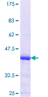 POMT1 Protein - 12.5% SDS-PAGE Stained with Coomassie Blue.