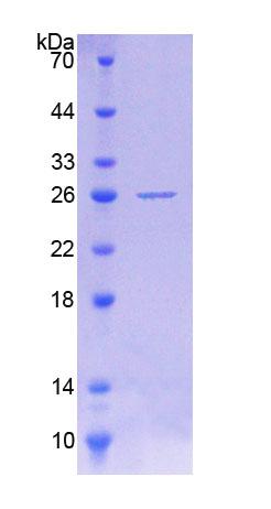 POMT1 Protein - Recombinant  Protein O-Mannosyltransferase 1 By SDS-PAGE