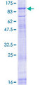 POMT2 Protein - 12.5% SDS-PAGE of human POMT2 stained with Coomassie Blue