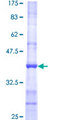 POMT2 Protein - 12.5% SDS-PAGE Stained with Coomassie Blue.