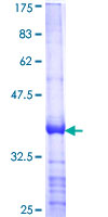 PON1 / ESA Protein - 12.5% SDS-PAGE Stained with Coomassie Blue