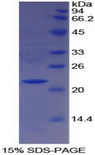 PON1 / ESA Protein - Recombinant Paraoxonase 1 By SDS-PAGE