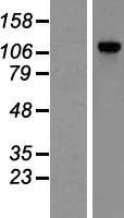 POP1 Protein - Western validation with an anti-DDK antibody * L: Control HEK293 lysate R: Over-expression lysate