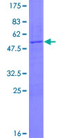 POP4 Protein - 12.5% SDS-PAGE of human POP4 stained with Coomassie Blue