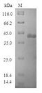 POP7 Protein - (Tris-Glycine gel) Discontinuous SDS-PAGE (reduced) with 5% enrichment gel and 15% separation gel.