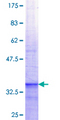 POP7 Protein - 12.5% SDS-PAGE Stained with Coomassie Blue.