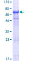 POPDC2 Protein - 12.5% SDS-PAGE of human POPDC2 stained with Coomassie Blue