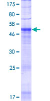 POPDC3 Protein - 12.5% SDS-PAGE of human POPDC3 stained with Coomassie Blue