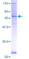 PORCN Protein - 12.5% SDS-PAGE of human PORCN stained with Coomassie Blue