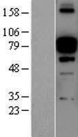 POSTN / Periostin Protein - Western validation with an anti-DDK antibody * L: Control HEK293 lysate R: Over-expression lysate