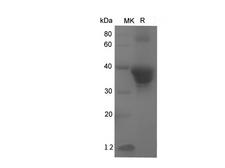 POSTN / Periostin Protein - Recombinant Human POSTN Protein (His Tag)-Elabscience