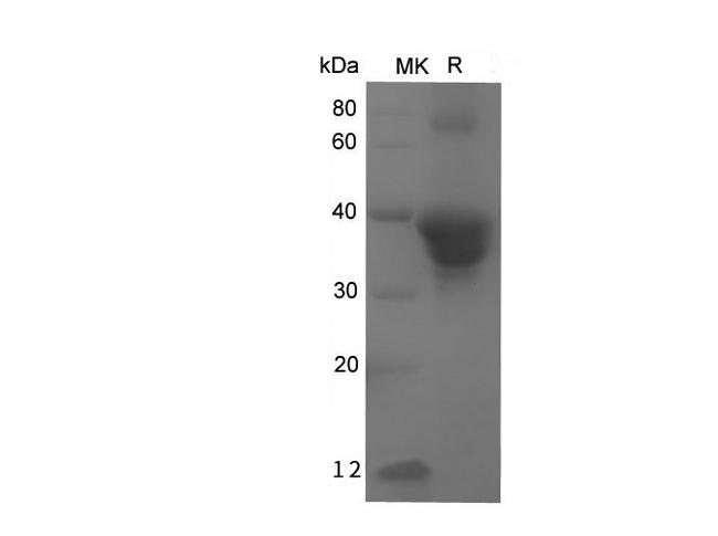 POSTN / Periostin Protein - Recombinant Human POSTN Protein (His Tag)-Elabscience