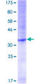 POT1 Protein - 12.5% SDS-PAGE Stained with Coomassie Blue.