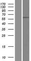 POTEA / POTE8 Protein - Western validation with an anti-DDK antibody * L: Control HEK293 lysate R: Over-expression lysate