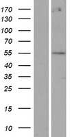 POTEA / POTE8 Protein - Western validation with an anti-DDK antibody * L: Control HEK293 lysate R: Over-expression lysate