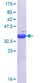 POTED / POTE Protein - 12.5% SDS-PAGE Stained with Coomassie Blue.