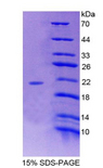 POTEG Protein - Recombinant POTE Ankyrin Domain Family, Member G By SDS-PAGE