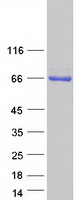POTEG Protein - Purified recombinant protein POTEG was analyzed by SDS-PAGE gel and Coomassie Blue Staining