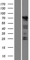 POTEI Protein - Western validation with an anti-DDK antibody * L: Control HEK293 lysate R: Over-expression lysate