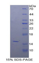 POTEJ Protein - Recombinant POTE Ankyrin Domain Family, Member J By SDS-PAGE