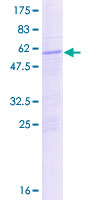 POU1F1 / PIT1 Protein - 12.5% SDS-PAGE of human POU1F1 stained with Coomassie Blue